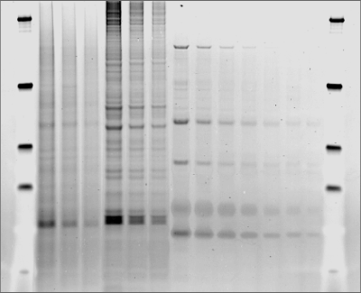 Figure 1: Pro-Q Diamond Phosphoprotein Stain