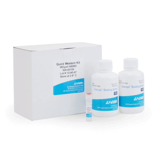 Quick Western Kit Saves Immunoblotting Time